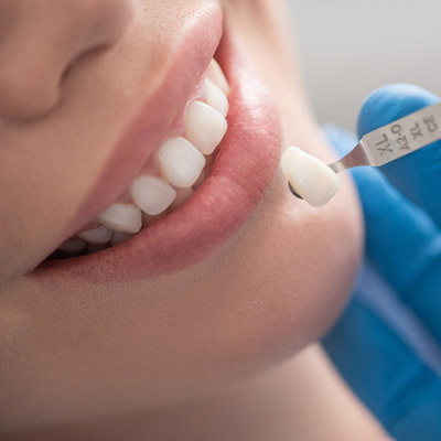 Am I Right for Dental Implants?